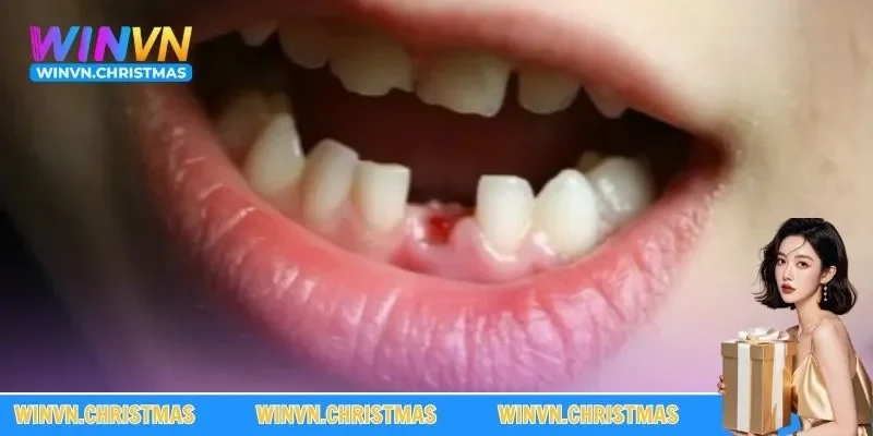 Ngủ mơ gãy răng hàm dưới